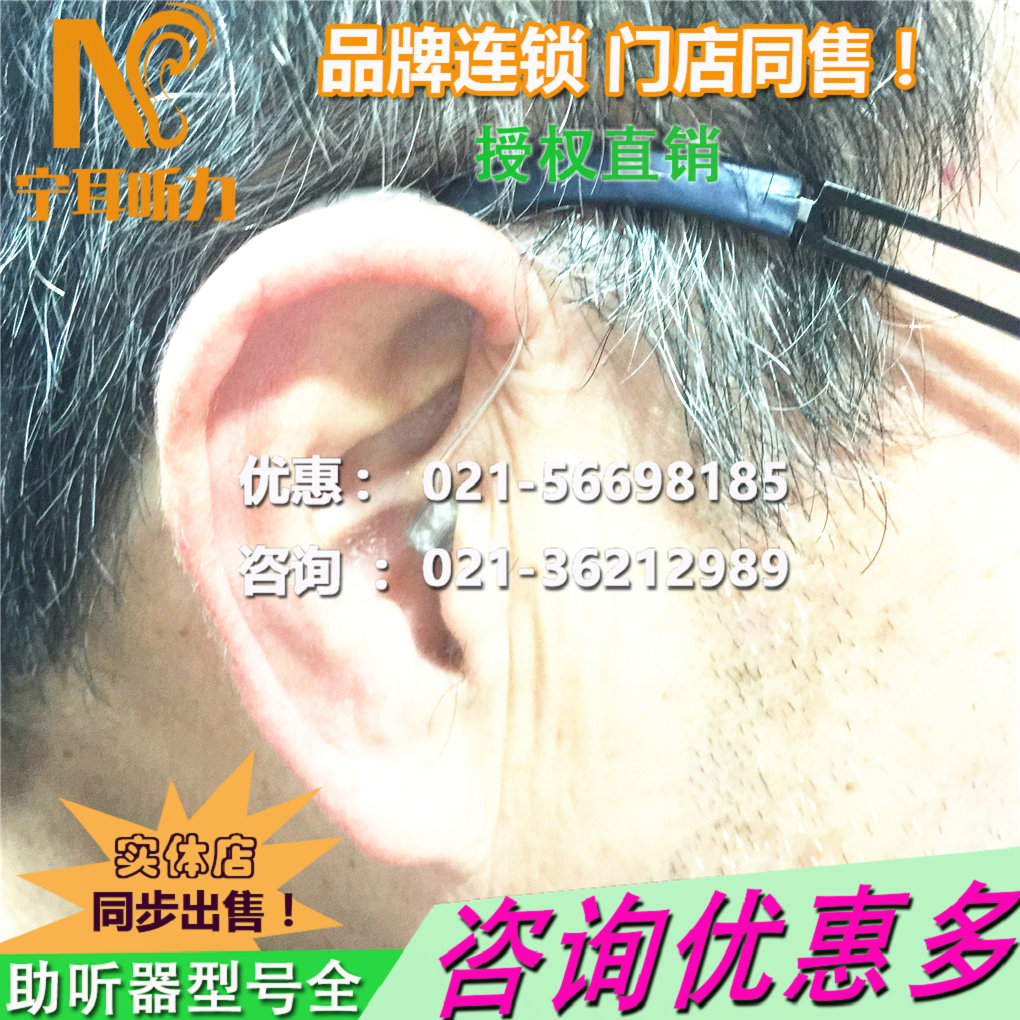 ϺR (tng)I-