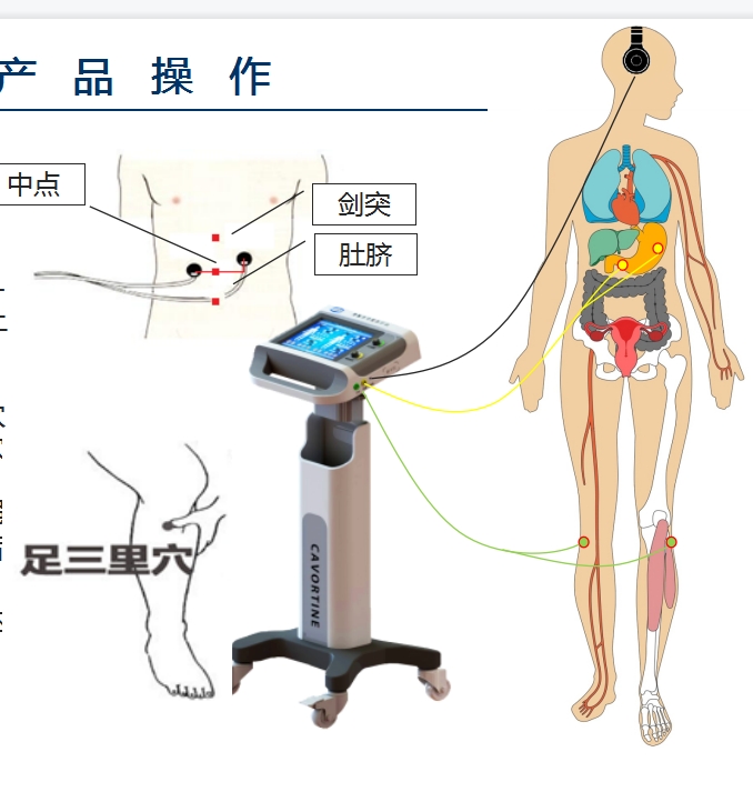 數(shù)字音樂電胃腸功能治療儀-消化內(nèi)科。重癥ICU