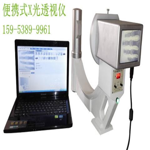 照射骨頭用的便攜X光機(jī)